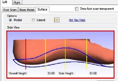 analyse du pied en 3D